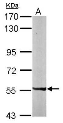 Western Blot: PXK Antibody [NBP1-33230] - Sample (50 ug of whole cell lysate) A: Mouse brain 7. 5% SDS PAGE; antibody diluted at 1:1000.