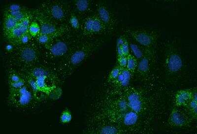 Immunocytochemistry/Immunofluorescence: PXMP4 Antibody [NBP3-05927] - Staining of PXMP4 in CACO2 cells. Cells were fixed with 4% PFA, permeabilzed with 0.1% Triton X-100 in PBS,blocked with 10% serum, and incubated with rabbit anti-Human PXMP4 polyclonal antibody (dilution ratio 1:200) at 4? overnight. Then cells were stained with the Alexa Fluor®488-conjugated Goat Anti-rabbit IgG secondary antibody (green) and counterstained with DAPI (blue).Positive staining was localized to Cytoplasm