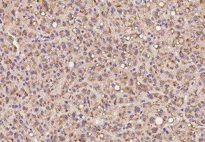 Immunohistochemistry-Paraffin: PXMP4 Antibody [NBP3-05927] - Human PXMP4 in human liver with rabbit polyclonal antibody at 1:100 dilution.