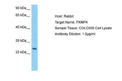 Western Blot: PXMP4 Antibody [NBP2-85561] - Host: Rabbit. Target Name: PXMP4. Sample Type: COLO205 Whole Cell lysates. Antibody Dilution: 1.0ug/ml