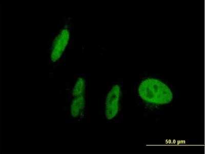 Immunocytochemistry/Immunofluorescence: PXR/NR1I2 Antibody [H00008856-B01P] - Analysis of purified antibody to NR1I2 on HepG2 cell. (antibody concentration 10 ug/ml)