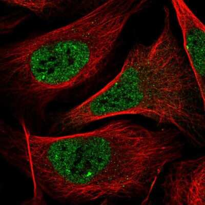 Immunocytochemistry/Immunofluorescence: PXR/NR1I2 Antibody [NBP2-55441] - Staining of human cell line U-2 OS shows localization to nucleoplasm & nuclear bodies.