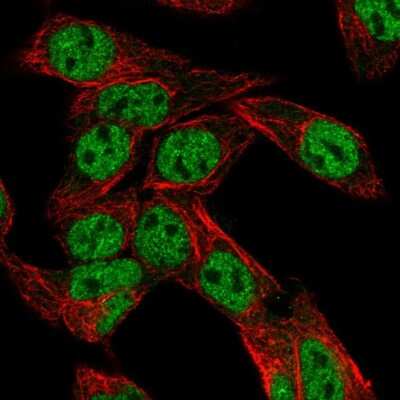 Immunocytochemistry/Immunofluorescence: PXR/NR1I2 Antibody [NBP2-56568] - Staining of human cell line Hep G2 shows localization to nucleoplasm.