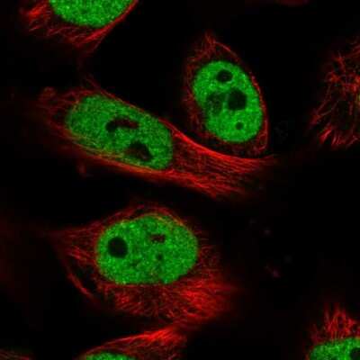 Immunocytochemistry/Immunofluorescence: PXR/NR1I2 Antibody [NBP2-58514] - Staining of human cell line U-251 MG shows localization to nucleoplasm.