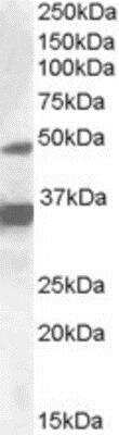 Western Blot: PXR/NR1I2 Antibody [NBP1-28799] - (1ug/ml) staining of HepG2 lysate (35ug protein in RIPA buffer). Primary incubation was 1 hour. Detected by chemiluminescence.