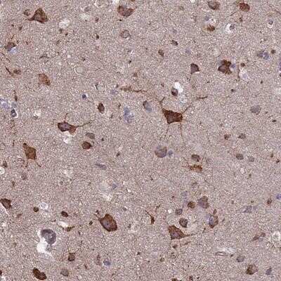 Immunohistochemistry-Paraffin: PYCR1 Antibody [NBP2-13834] - Staining of human cerebral cortex shows strong cytoplasmic positivity in neuronal cells.