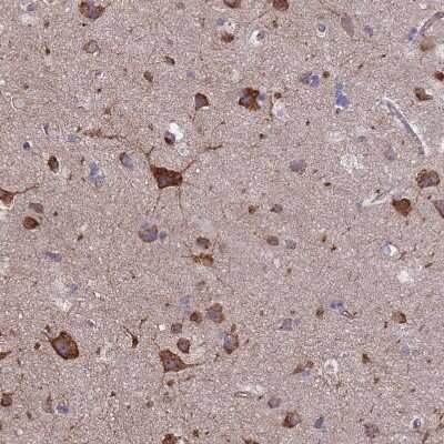 Immunohistochemistry-Paraffin: PYCR1 Antibody [NBP2-13834] - Staining of human cerebral cortex shows strong cytoplasmic positivity in neurons.