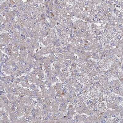 Immunohistochemistry-Paraffin: PYCR1 Antibody [NBP2-13834] - Staining of human liver shows low positivity in hepatocytes as expected.