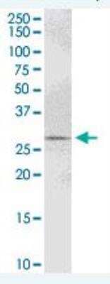 Western Blot: PYCR1 Antibody [H00005831-B01P] - Expression in U-2 OS.