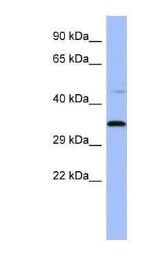 Western Blot: PYCR1 Antibody [NBP1-57934] - Titration: 0.2-1 ug/ml, Positive Control: 721_B cell lysate.