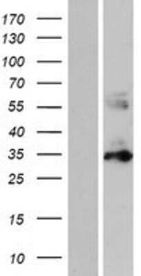 Western Blot: PYCR1 Overexpression Lysate (Adult Normal) [NBP2-05230] Left-Empty vector transfected control cell lysate (HEK293 cell lysate); Right -Over-expression Lysate for PYCR1.