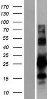 Western Blot: PYCR1 Overexpression Lysate (Adult Normal) [NBP2-07559] Left-Empty vector transfected control cell lysate (HEK293 cell lysate); Right -Over-expression Lysate for PYCR1.