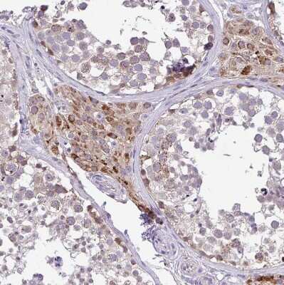 Immunohistochemistry-Paraffin: PYCR2 Antibody [NBP2-47318] - Staining of human testis shows moderate granular cytoplasmic positivity in Leydig cells.