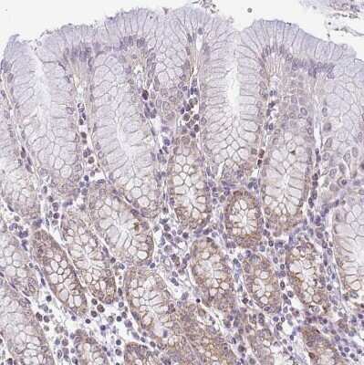 Immunohistochemistry-Paraffin: PYCR2 Antibody [NBP2-47318] - Staining of human stomach shows weak to moderate granular cytoplasmic positivity in glandular cells.