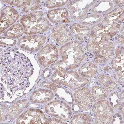 Immunohistochemistry-Paraffin: PYCR2 Antibody [NBP2-47318] - Staining of human kidney shows weak granular cytoplasmic positivity in cells in tubules.