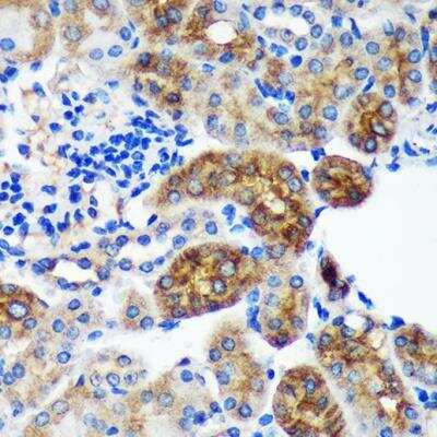 Immunohistochemistry-Paraffin: PYCR2 Antibody [NBP2-93882] - Mouse kidney using PYCR2 Rabbit pAb at dilution of 1:100 (40x lens).
