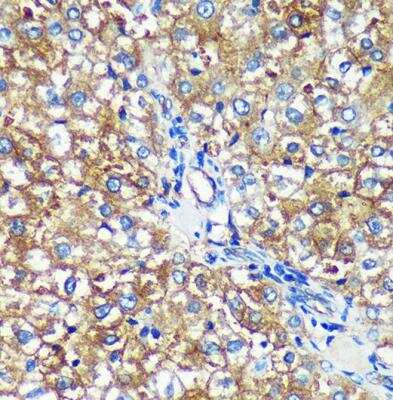 Immunohistochemistry-Paraffin: PYCR2 Antibody [NBP2-93882] - Rat liver using PYCR2 Rabbit pAb at dilution of 1:100 (40x lens).