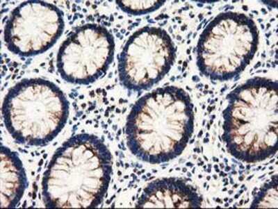 Immunohistochemistry: PYCR2 Antibody (OTI3D1) - Azide and BSA Free [NBP2-73743] - Staining of paraffin-embedded Human colon tissue using anti-PYCR2 mouse monoclonal antibody.