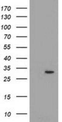 Western Blot: PYCR2 Antibody (OTI3D1) - Azide and BSA Free [NBP2-73743] - HEK293T cells were transfected with the pCMV6-ENTRY control (Left lane) or pCMV6-ENTRY PYCR2 (Right lane) cDNA for 48 hrs and lysed. Equivalent amounts of cell lysates (5 ug per lane) were separated by SDS-PAGE and immunoblotted with anti-PYCR2.