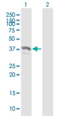 Western Blot: PYCR2 Antibody [H00029920-B02P] - Analysis of PYCR2 expression in transfected 293T cell line by PYCR2 polyclonal antibody.  Lane 1: PYCR2 transfected lysate(33.60 KDa). Lane 2: Non-transfected lysate.