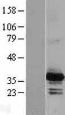 Western Blot: PYCR2 Overexpression Lysate (Adult Normal) [NBL1-15018] Left-Empty vector transfected control cell lysate (HEK293 cell lysate); Right -Over-expression Lysate for PYCR2.