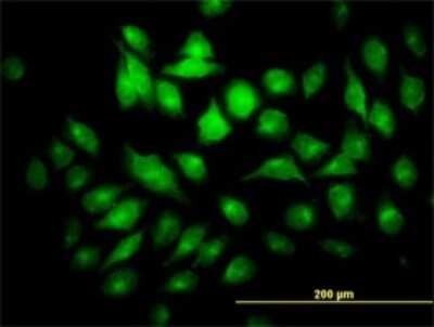 Immunocytochemistry/Immunofluorescence: PYCRL Antibody (4F11) [H00065263-M01] - Analysis of monoclonal antibody to PYCRL on HeLa cell. Antibody concentration 10 ug/ml.