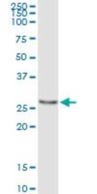 Immunoprecipitation: PYCRL Antibody (4F11) [H00065263-M01] - Analysis of PYCRL transfected lysate using anti-PYCRL monoclonal antibody and Protein A Magnetic Bead, and immunoblotted with PYCRL monoclonal antibody.