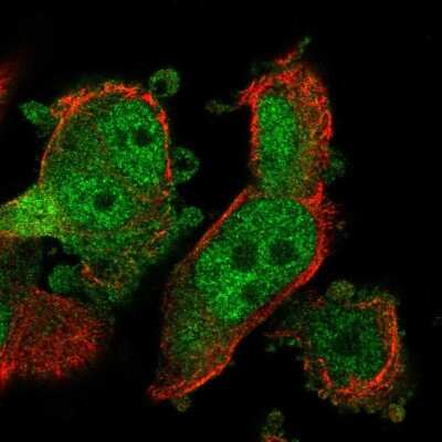 Immunocytochemistry/Immunofluorescence: PYCRL Antibody [NBP2-49396] - Immunofluorescent staining of human cell line PC-3 shows localization to nucleoplasm & cytosol.