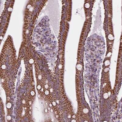 Immunohistochemistry: PYCRL Antibody [NBP2-49611] - Staining of human small intestine shows strong granular positivity in glandular cells.