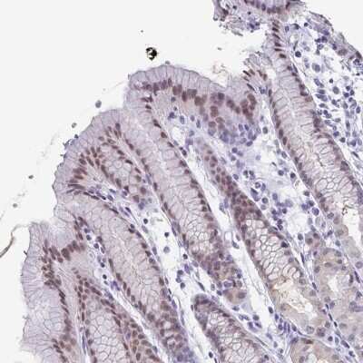 Immunohistochemistry-Paraffin: PYCRL Antibody [NBP2-49396] - Staining of human stomach shows moderate nuclear positivity in glandular cells.