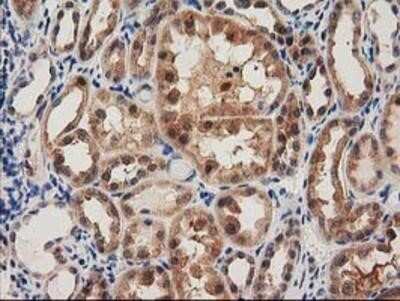 Immunohistochemistry-Paraffin: PYCRL Antibody (OTI1B12) [NBP2-03337] - Staining of paraffin-embedded Human Kidney tissue using anti-PYCRL mouse monoclonal antibody.