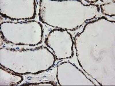 Immunohistochemistry-Paraffin: PYCRL Antibody (OTI1B12) [NBP2-03337] - Staining of paraffin-embedded Human thyroid tissue using anti-PYCRL mouse monoclonal antibody.