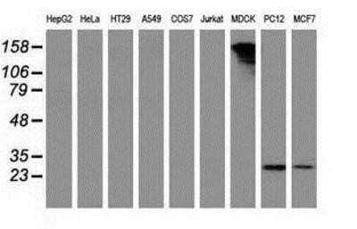 Western Blot: PYCRL Antibody (OTI1B12) [NBP2-03337] - Analysis of extracts (35ug) from 9 different cell lines by using anti-PYCRL monoclonal antibody.