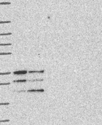 Western Blot: PYCRL Antibody [NBP3-17918] - Lane 1: Marker [kDa] 250, 130, 95, 72, 55, 36, 28, 17, 10;   Lane 2: RT4;   Lane 3: U-251 MG;   Lane 4: Human Plasma;   Lane 5: Liver;   Lane 6: Tonsil