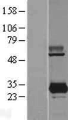 Western Blot: PYCRL Overexpression Lysate (Adult Normal) [NBL1-15019] Left-Empty vector transfected control cell lysate (HEK293 cell lysate); Right -Over-expression Lysate for PYCRL.