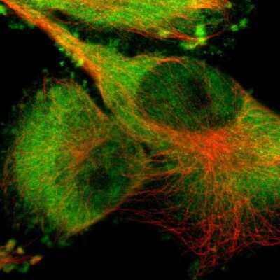 Immunocytochemistry/Immunofluorescence: PYGL Antibody [NBP1-86182] - Staining of human cell line U-251 MG shows localization to nucleoplasm, plasma membrane & cytosol. Antibody staining is shown in green.