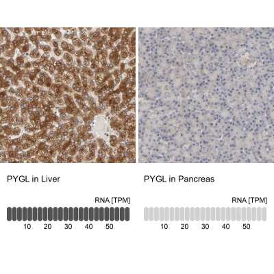 <b>Orthogonal Strategies Validation. </b>Immunohistochemistry-Paraffin: PYGL Antibody [NBP1-86147] - Analysis in human liver and pancreas tissues. Corresponding PYGL RNA-seq data are presented for the same tissues.