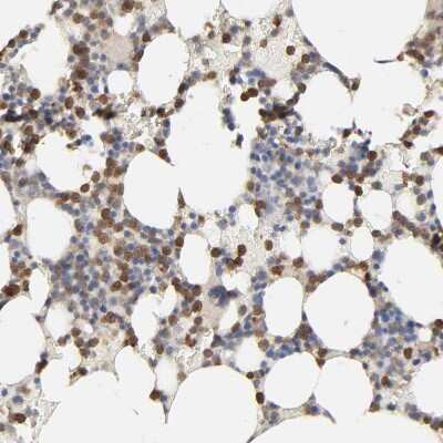 Immunohistochemistry-Paraffin: PYGL Antibody [NBP1-86147] - Staining of human bone marrow shows moderate cytoplasmic positivity in hematopoietic cells.