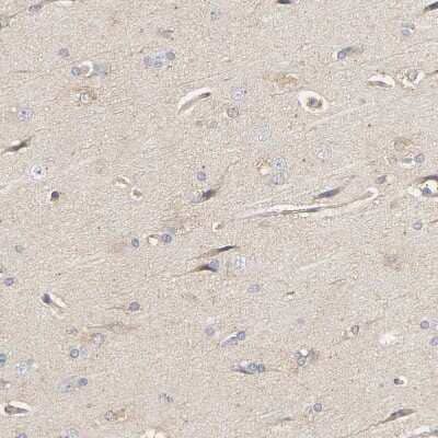 Immunohistochemistry-Paraffin: PYGL Antibody [NBP1-86147] - Staining of human cerebral cortex shows very weak positivity in neuronal cells.