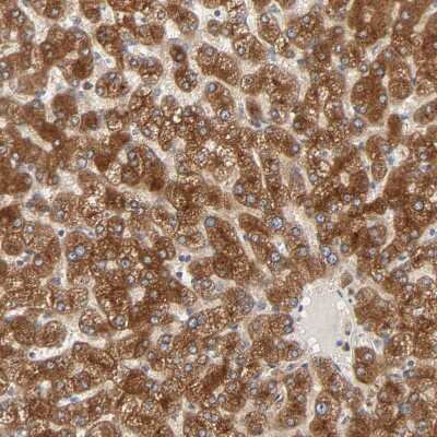 Immunohistochemistry-Paraffin: PYGL Antibody [NBP1-86147] - Staining of human liver shows strong cytoplasmic positivity in hepatocytes.