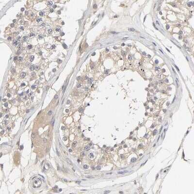 Immunohistochemistry-Paraffin: PYGL Antibody [NBP1-86147] - Staining of human testis shows very weak positivity in cells in seminiferous ducts.