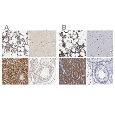 <b>Independent Antibodies Validation. </b>Immunohistochemistry-Paraffin: PYGL Antibody [NBP1-86147] - Staining of human bone marrow, cerebral cortex, liver and testis using Anti-PYGL antibody (A) NBP1-86147 shows similar protein distribution across tissues to independent antibody NBP1-86182 (B).