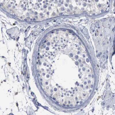 Immunohistochemistry-Paraffin: PYGL Antibody [NBP1-86182] - Staining of human testis shows no positivity in cells in seminiferous ducts.