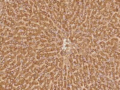 Immunohistochemistry-Paraffin: PYGL Antibody [NBP2-97708] - Immunochemical staining of human PYGL in human liver with rabbit polyclonal antibody at 1:300 dilution, formalin-fixed paraffin embedded sections.