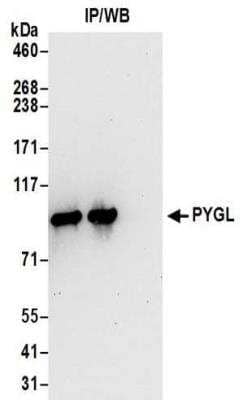 <b>Biological Strategies Validation. </b>Immunoprecipitation: PYGL Antibody [NBP2-32246] - Samples:  Whole cell lysate (0.5 or 1.0 mg per IP reaction; 20% of IP loaded) prepared using RIPA buffer from 293T cells.  Antibodies:  Affinity purified rabbit anti-PYGL antibody NBP2-32246 used for IP at 6 ug per reaction. PYGL was also immunoprecipitated by rabbit anti-PYGL antibody BL15846.  For blotting immunoprecipitated PYGL, NBP2-32246 was used at 1 ug/ml. Detection: Chemiluminescence with an exposure time of 30 seconds.