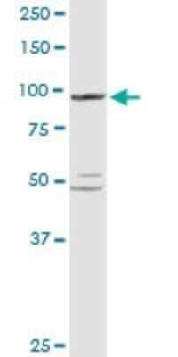 Western Blot: PYGL Antibody [H00005836-D01P] - Analysis of PYGL expression in human liver.