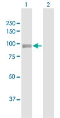 Western Blot: PYGL Antibody [H00005836-D01P] - Analysis of PYGL expression in transfected 293T cell line by PYGL polyclonal antibody.Lane 1: PYGL transfected lysate(97.10 KDa).Lane 2: Non-transfected lysate.