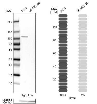 Western Blot: PYGL Antibody [NBP1-86147] - Analysis in human cell lines PC-3 and SK-MEL-30 using anti-PYGL antibody. Corresponding PYGL RNA-seq data are presented for the same cell lines. Loading control: anti-PFN1.