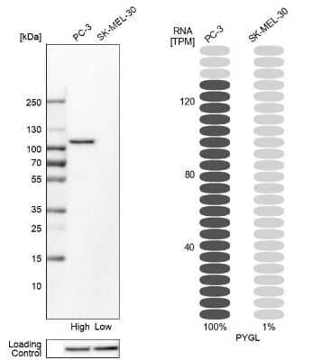 Western Blot: PYGL Antibody [NBP1-86182] - Analysis in human cell lines PC-3 and SK-MEL-30 using Anti-PYGL antibody. Corresponding PYGL RNA-seq data are presented for the same cell lines. Loading control: Anti-HSP90B1.