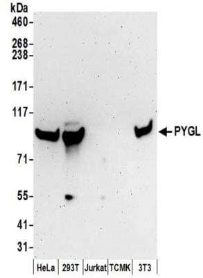 Western Blot: PYGL Antibody [NBP2-32246] - Samples:  Whole cell lysate (50 ug) prepared using NETN buffer from HeLa, 293T, Jurkat, mouse TCMK-1, and mouse NIH3T3 cells. Antibodies:  Affinity purified rabbit anti-PYGL antibody NBP2-32246 used for WB at 0.1 ug/ml.  Detection: Chemiluminescence with an exposure time of 3 minutes.